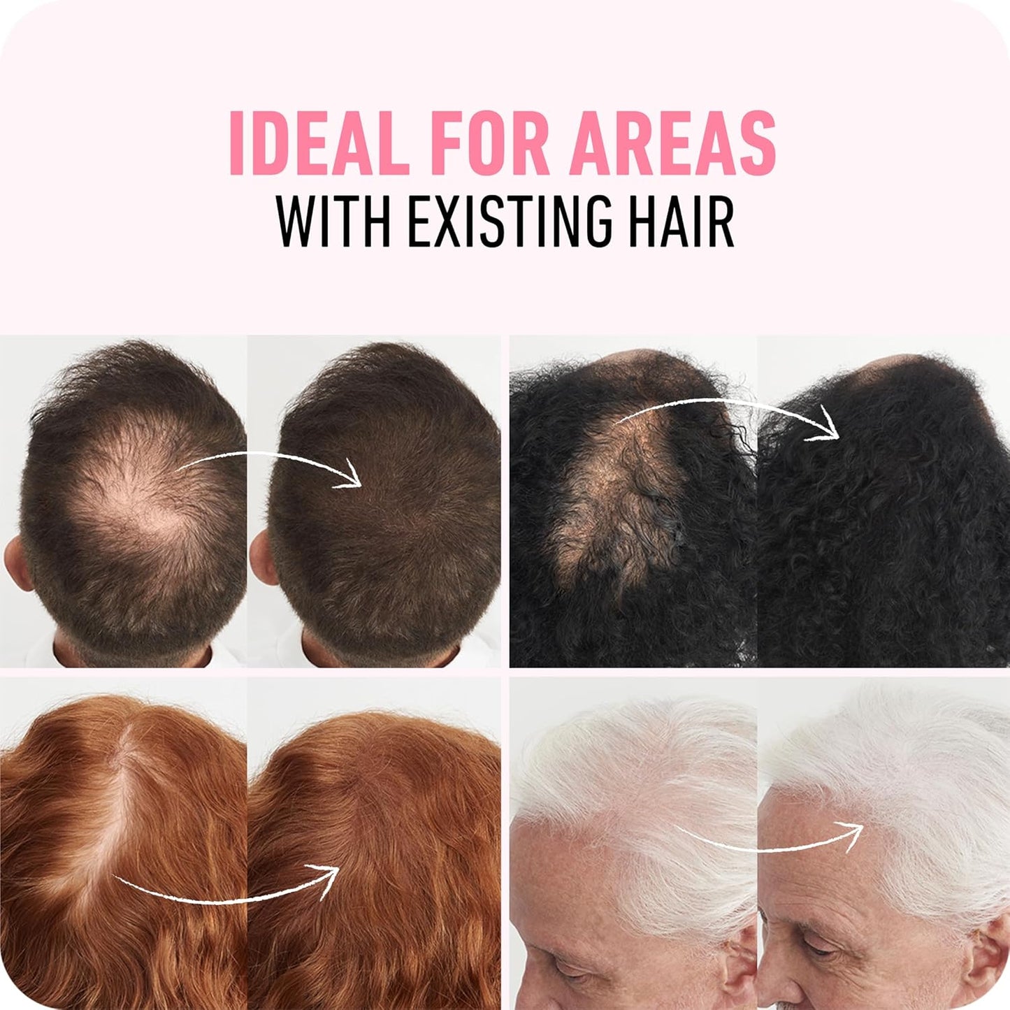 BOLDIFY Hair Fibers (56g) - Fill In Thinning and Fine Hair for an Instantly Fuller, Thicker Look - 14 Shades for Women & Men - Medium Brown