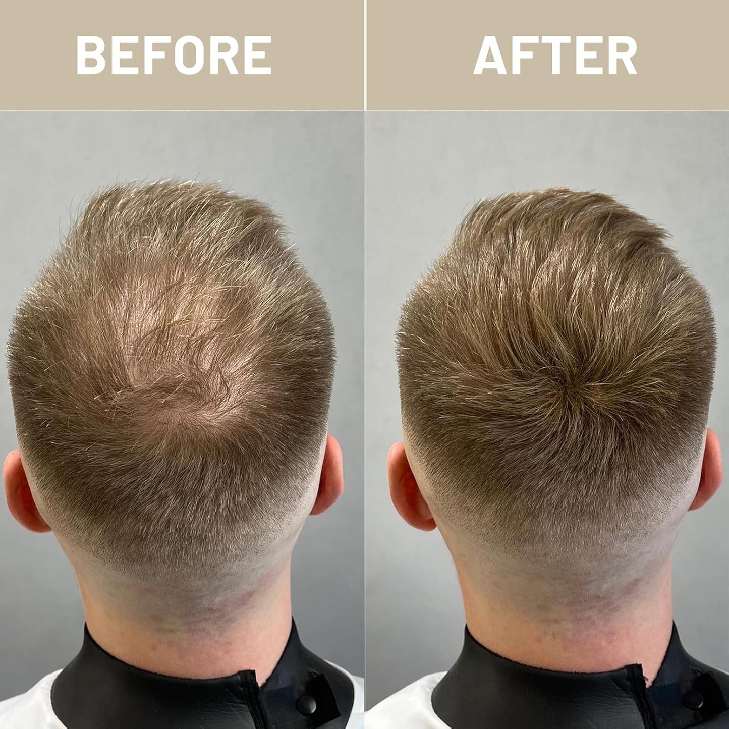 VOLLUCK Hair Fibers for Thinning Hair, Instant Coverage Hair Building Fibers for Women and men, Natural Hair Powder for Conceal Hair Loss 28 g (Dark Brown)