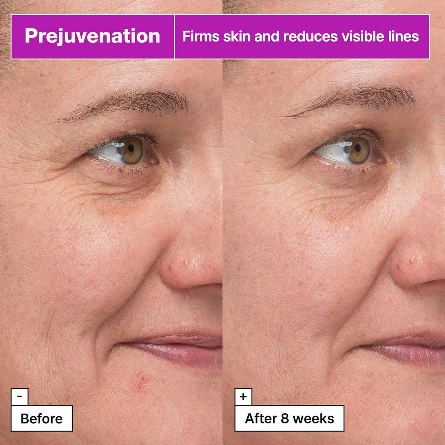 Dr.Jart+ Prejuvenation Firming Bakuchiol Serum with Collagen Peptides | Korean Anti Aging Serum |
