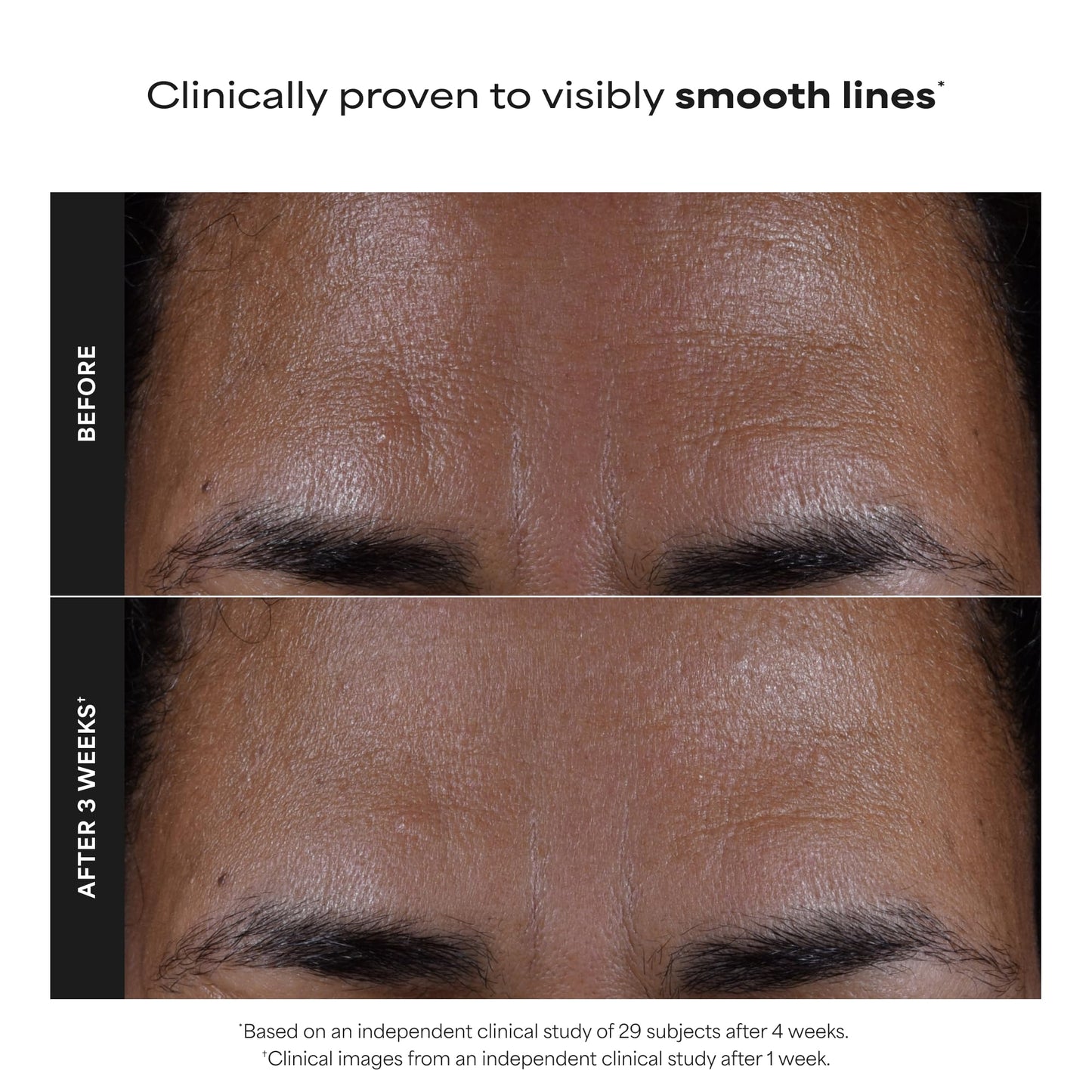 Paula's Choice SKIN PERFECTING 2% BHA Liquid Exfoliant, 5 Fl Oz (Pack of 2)