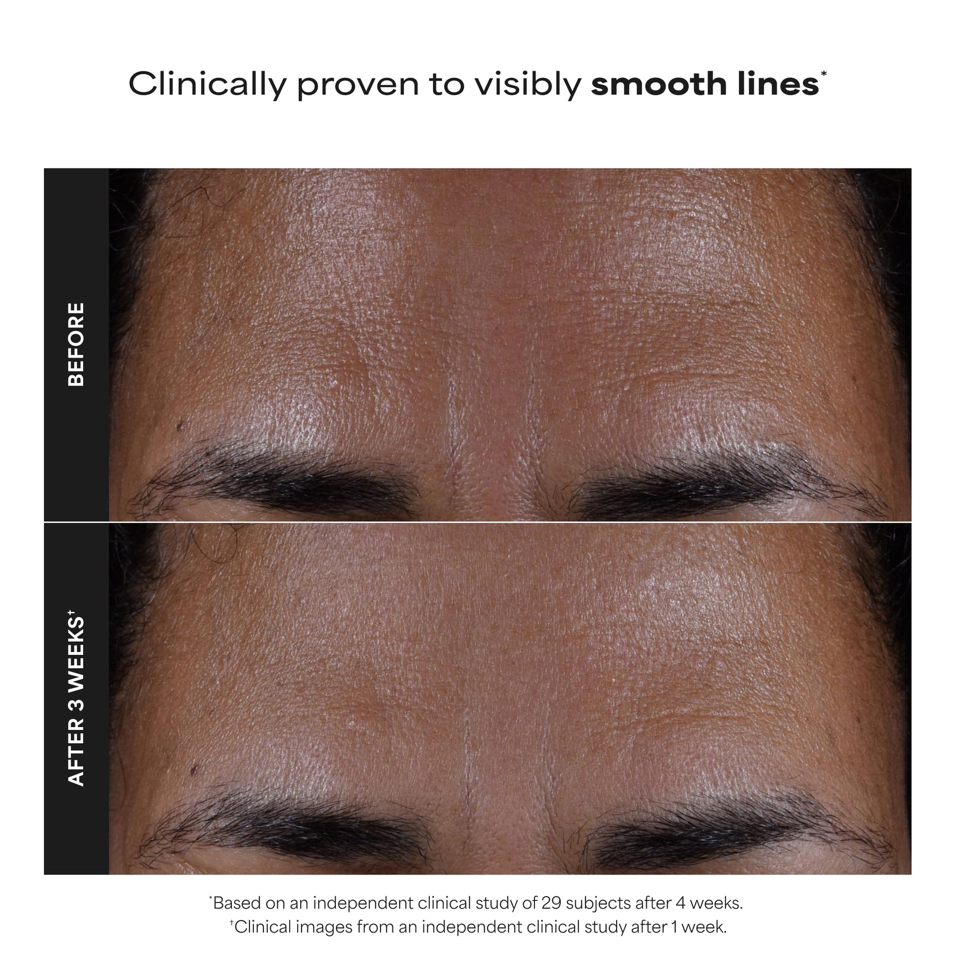 Paula's Choice SKIN PERFECTING 2% BHA Liquid Exfoliant, 5 Fl Oz (Pack of 2)