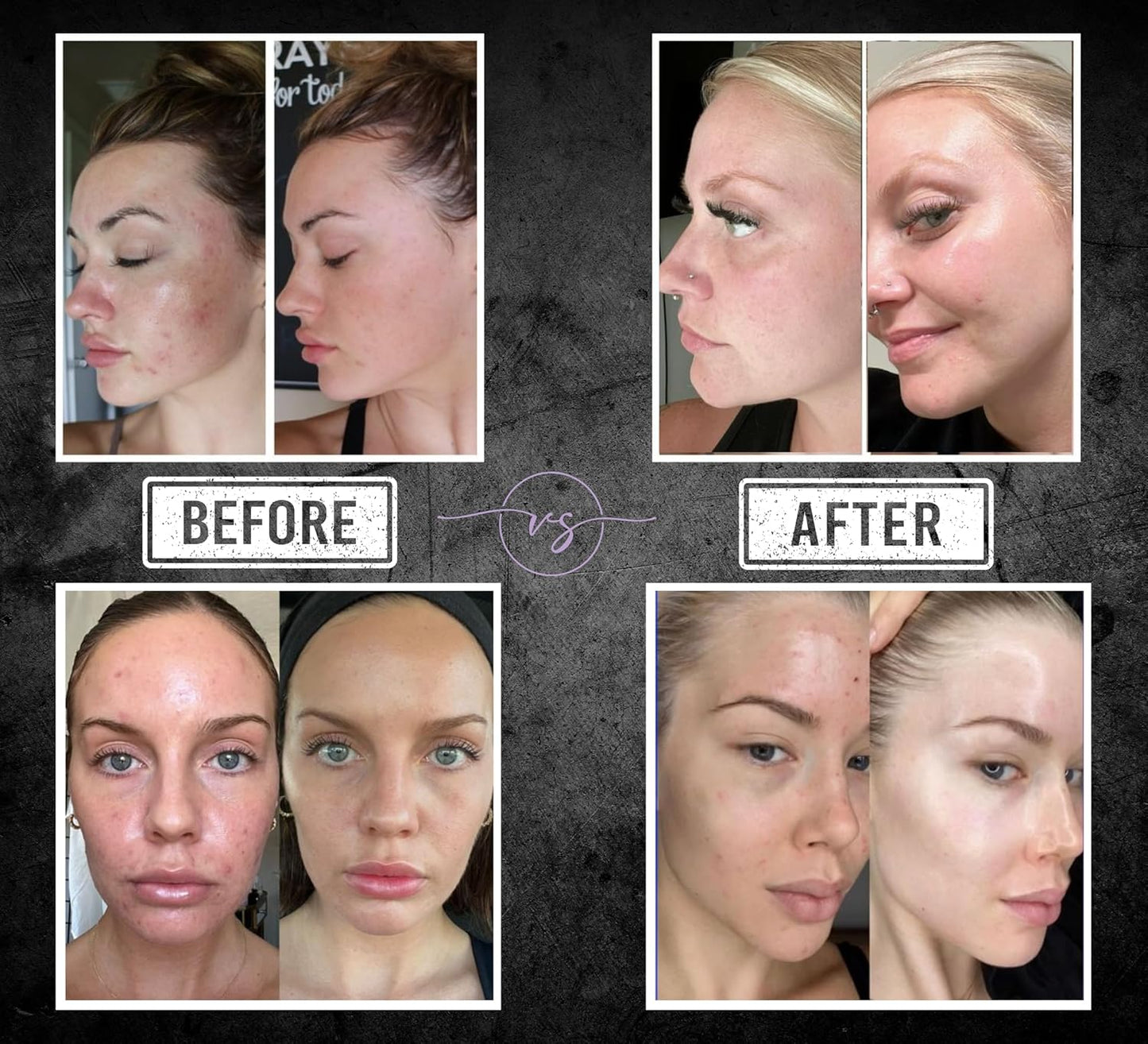 Luxurious Skincare Bar - The Only Sleep-Enhancing Premium Soap with Encapsulated Melatonin, Essential Oils & 40+ Ingredients - All-in-One Face & Body Evening Ritual - Large Block Format (10.6 oz)