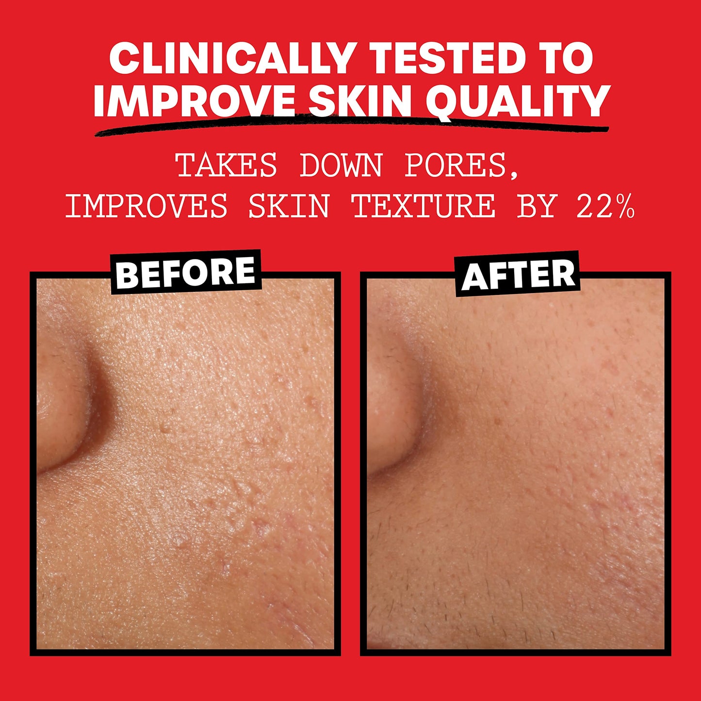 THAYERS Alcohol-Free, Hydrating Rose Petal Witch Hazel Facial Toner with Aloe Vera Formula, Vegan