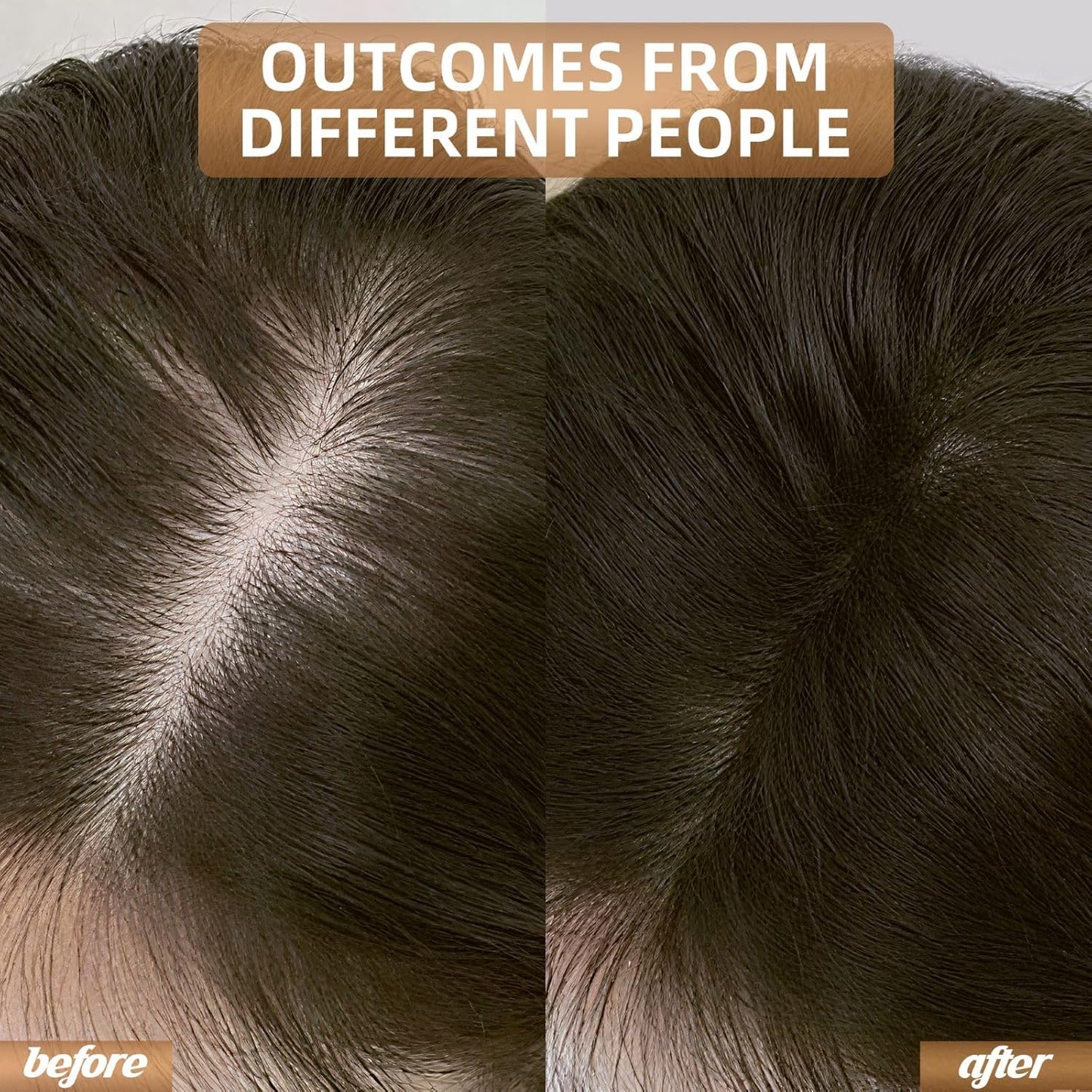 Red Light Therapy for Hair Growth, Breathable Cap Panels with Quick-Release Function