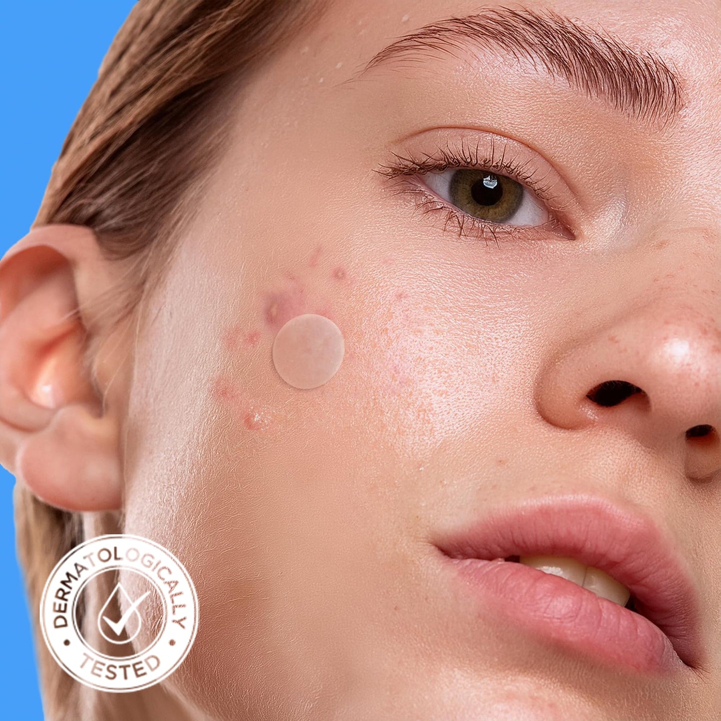 AVARELLE Original Hydrocolloid Acne Patches Korean Skincare 300 Count Bulk