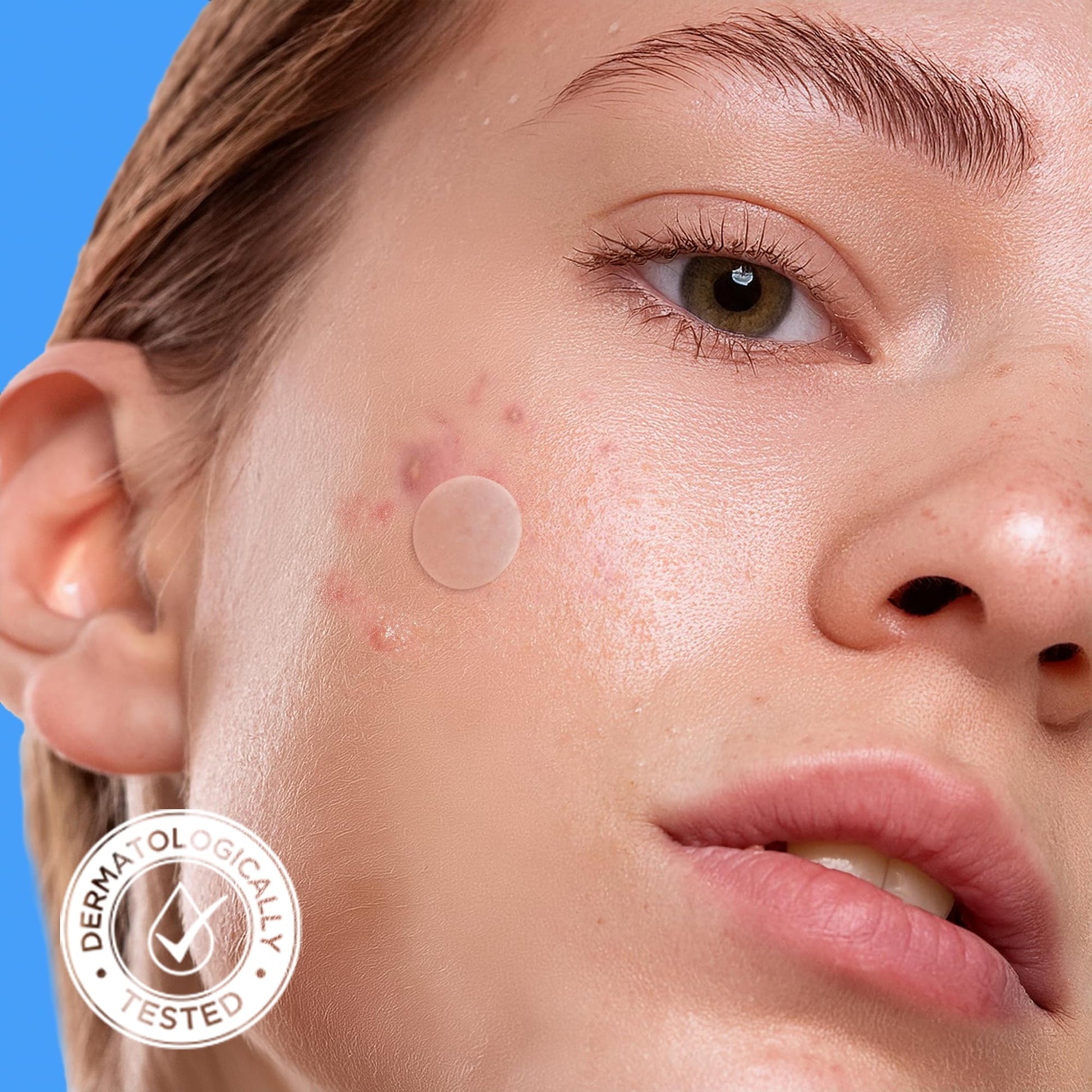AVARELLE Original Hydrocolloid Acne Patches Korean Skincare 300 Count Bulk
