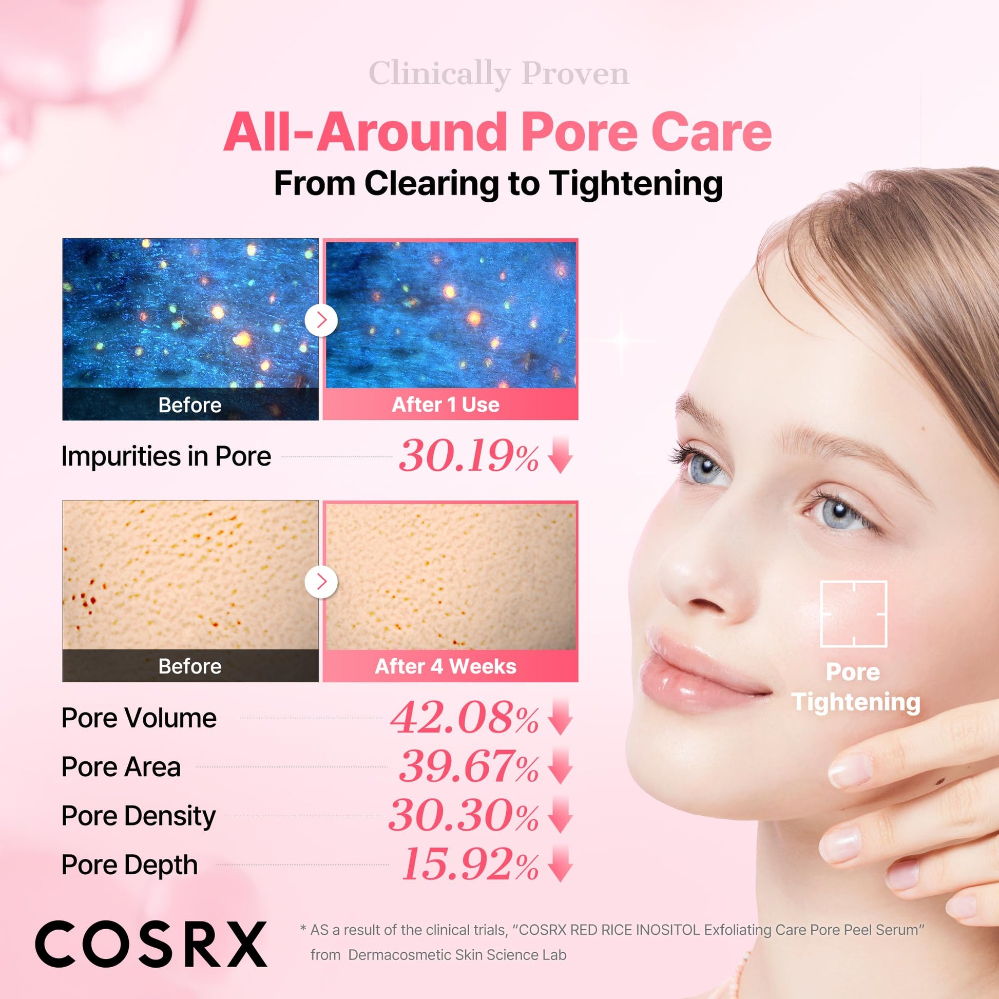 COSRX Red Rice Pore Peel Shot, Blackhead Remover AHA BHA PHA, 2.7 fl oz