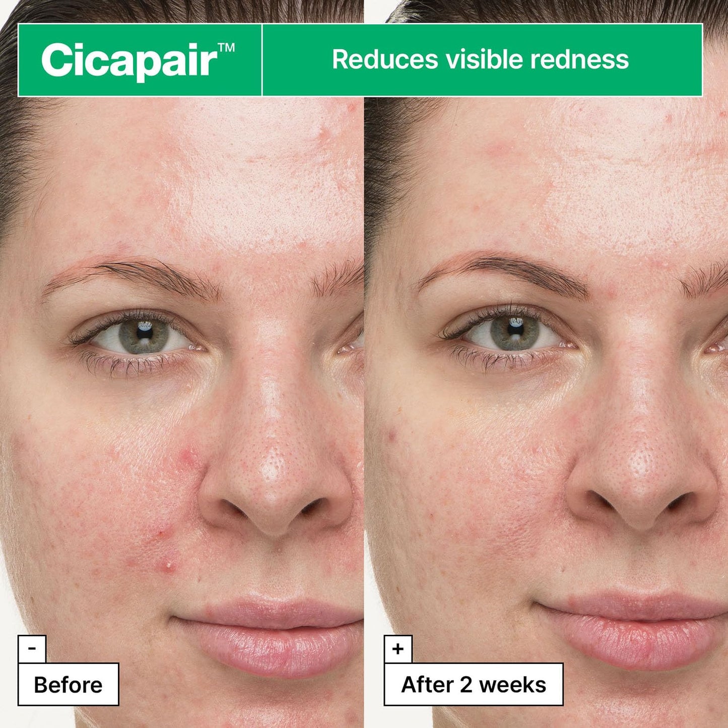 Dr.Jart+ Cicapair So Soothing Face Treatment Korean Gel Cream for Visibly Irritated Skin with