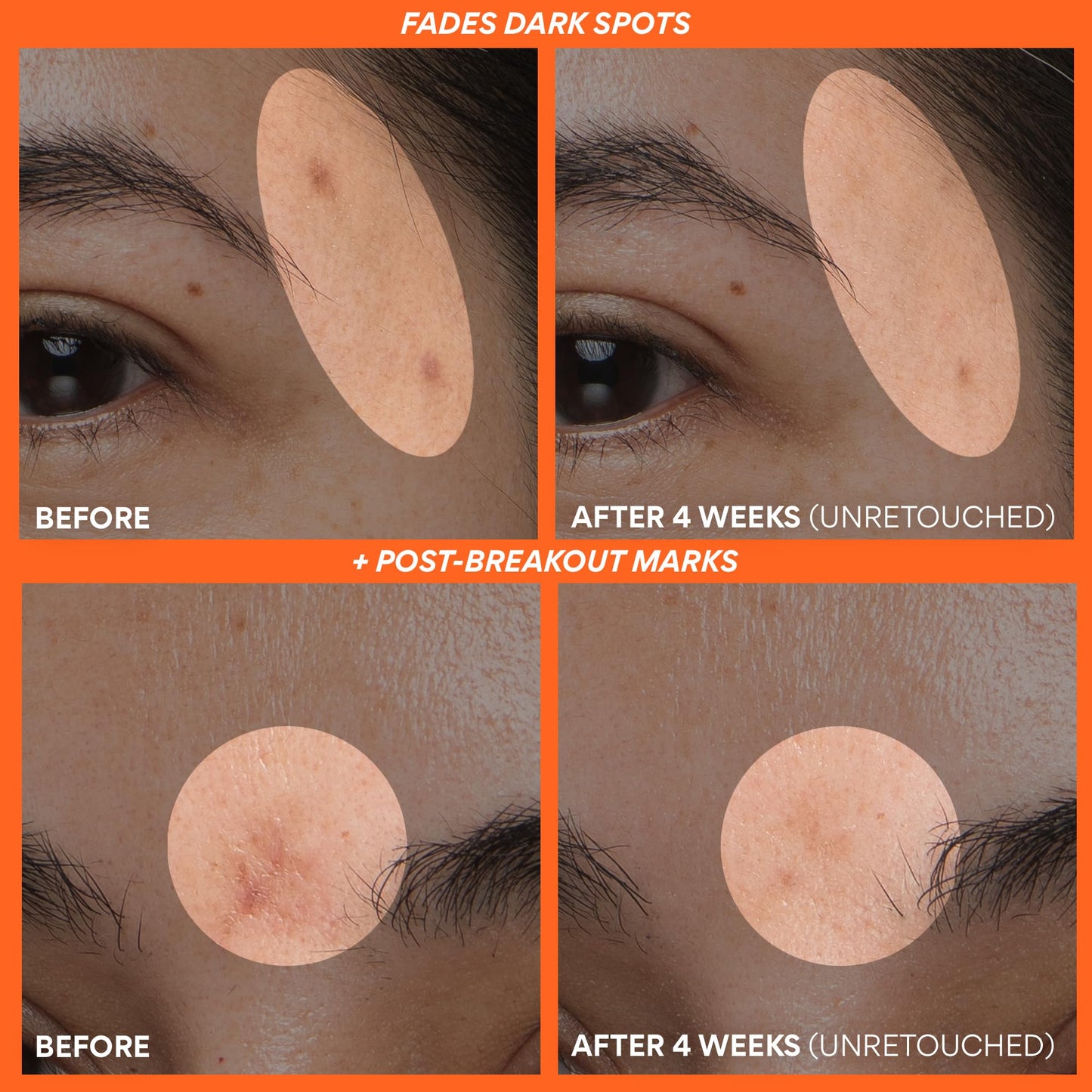 Innisfree Green Tea Enzyme Vitamin C Serum for Brightening | Sunspots, Post-Breakout Marks and Dark