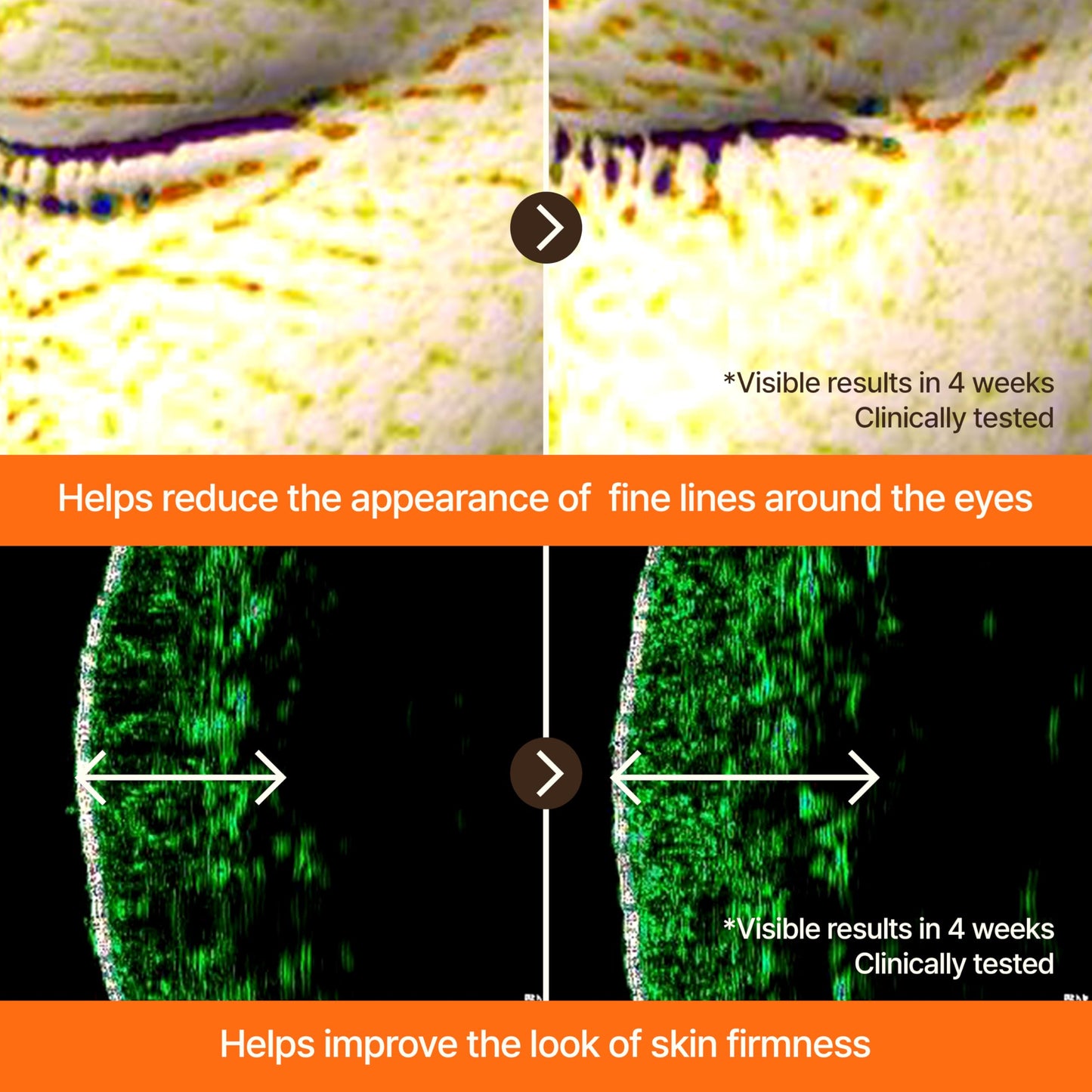 GOODAL Black Carrot VITA-A Retinal Intense Serum 8.0, Advanced Retinol Ampoule, Dark Spot