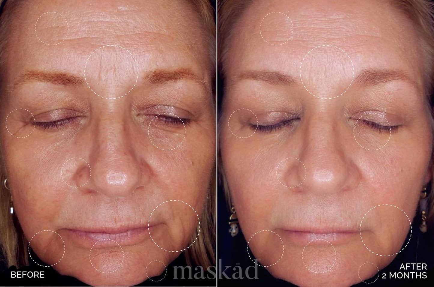 MASKĀD® Advanced Anti-Aging Multi-Peptide Enriched Facial Serum, Peptide Serum to Support Skin Appearance, Fine Lines, & Hydration, Collagen-Focused Care, Clean, Gentle Skin Care, Extra Large 2oz