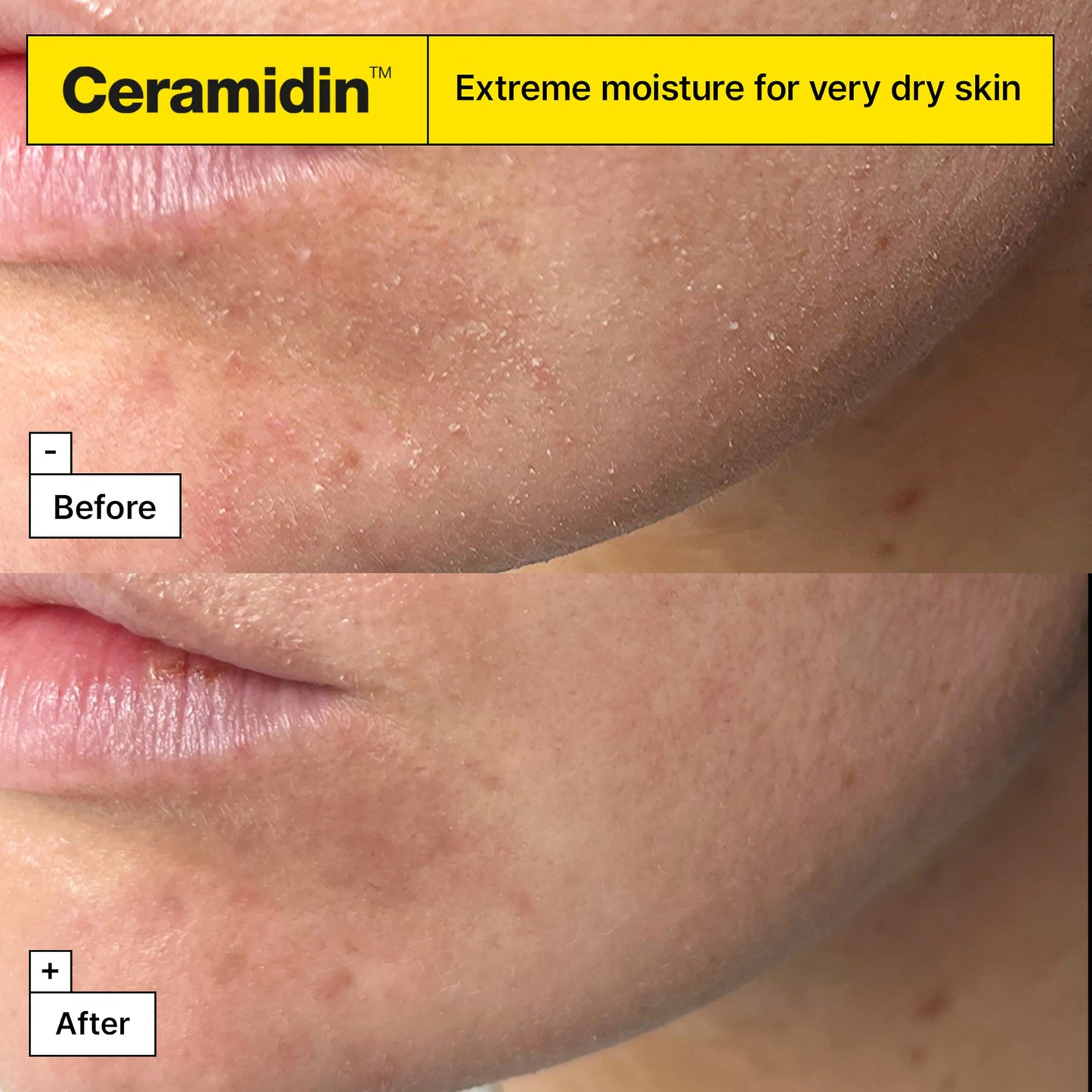 Dr.Jart+ Ceramidin Ectoin-Infused Korean Face Cream Moisturizer for Dry Skin | Korean Skin Care
