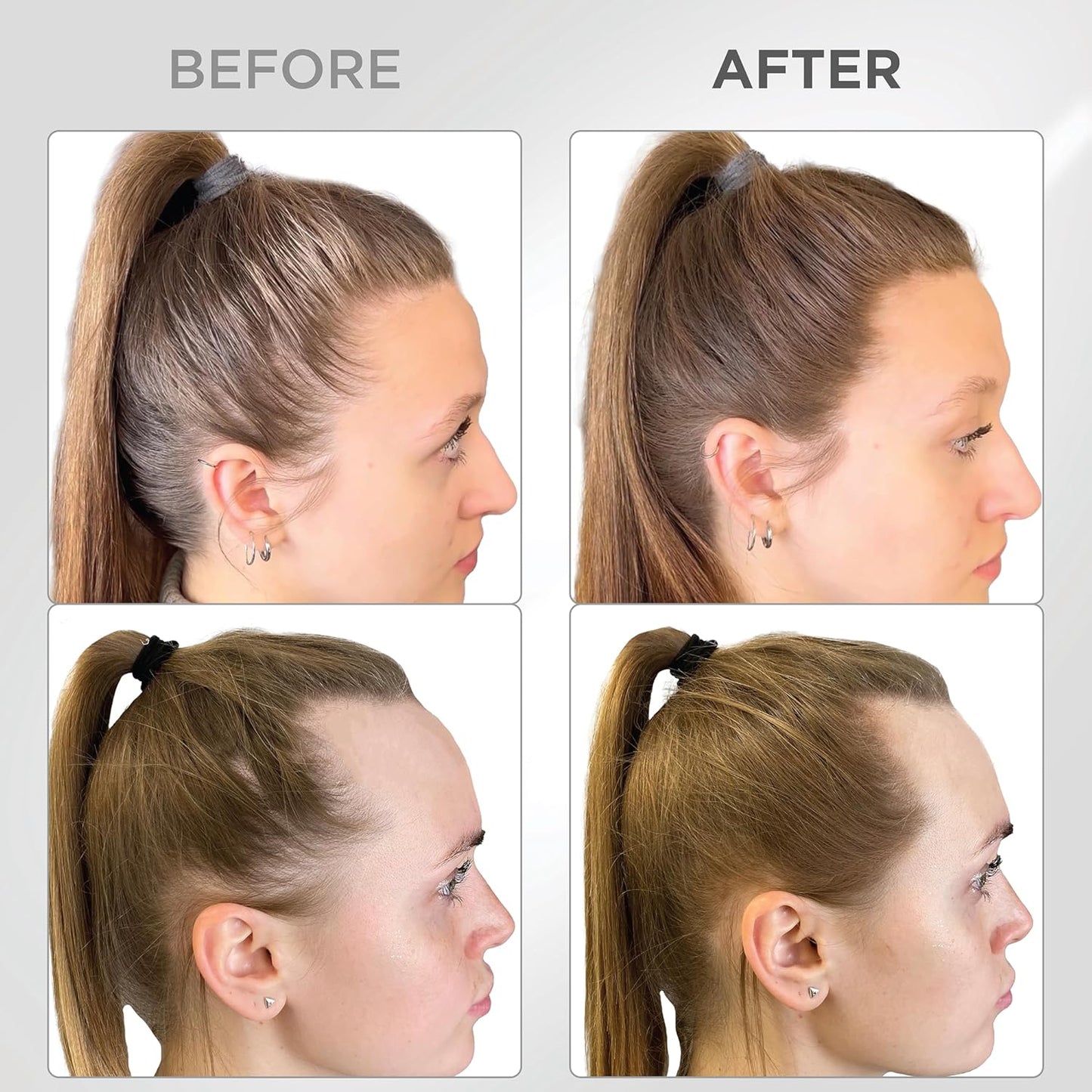 THICK FIBER Root Touch Up and Hairline Concealer - Water & Sweat Resistant Hair Loss Powder Set for Thinning Hair, Includes Brush (Light Brown)